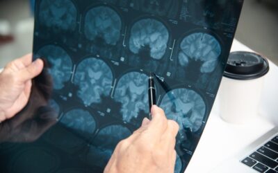 Common Causes of Brain Injury