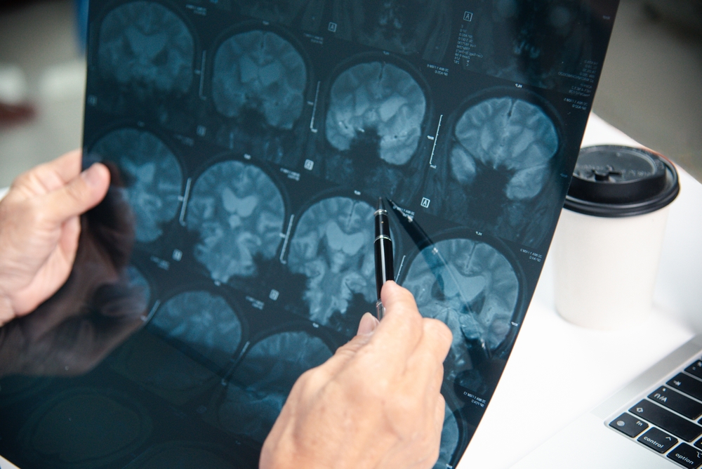Common Causes of Brain Injury
